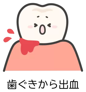 歯茎から出血